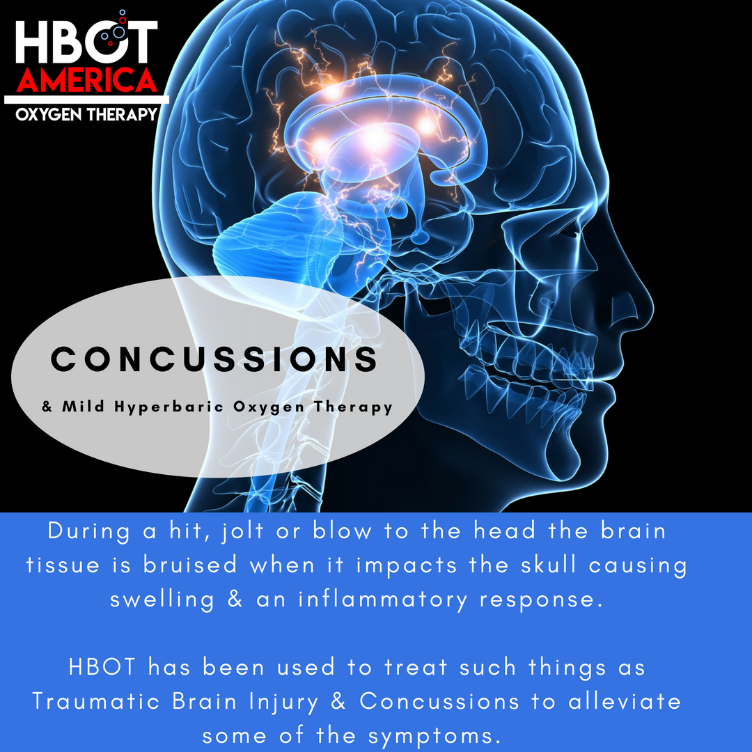 HBOT & Concussions